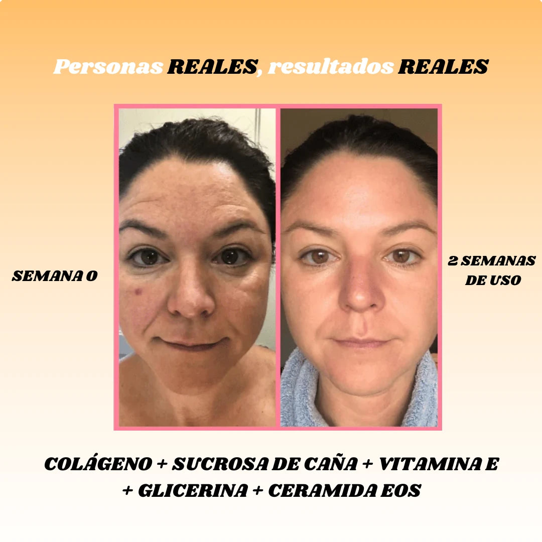 Kit 5 Mascarillas Boost Rejuvenecedor
